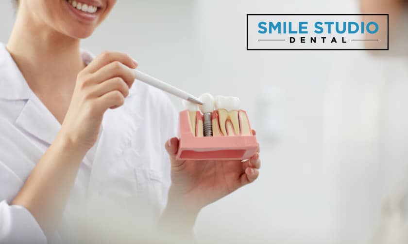How Much Do Dental Implants Cost?