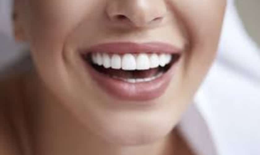 Are You a Good Fit for Dental Implants? Here’s What to Consider