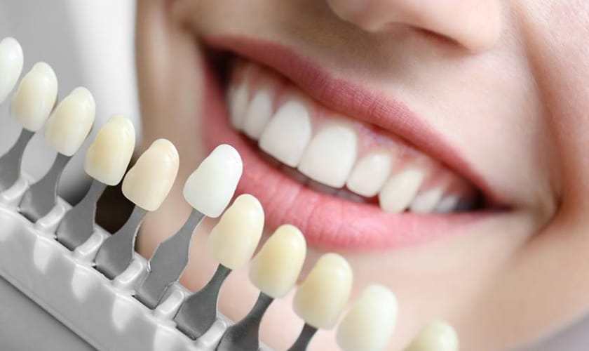 From Coffee Stains to Pearly Whites: Transforming Your Smile with Professional Whitening