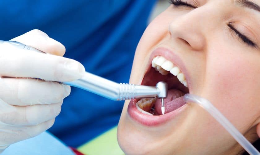 Say Goodbye To Yellow Teeth With White-Colour Tooth Bonding