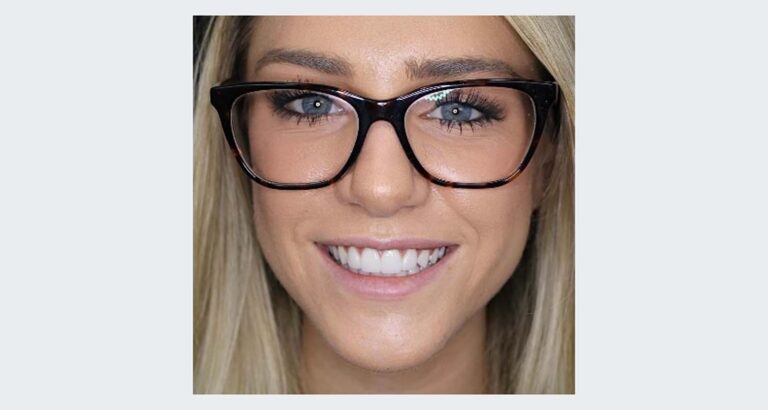 A full face photo showcasing Katie's straight teeth and bright white smile after getting dental veneers at Smile Studio Dental in Denver, CO.